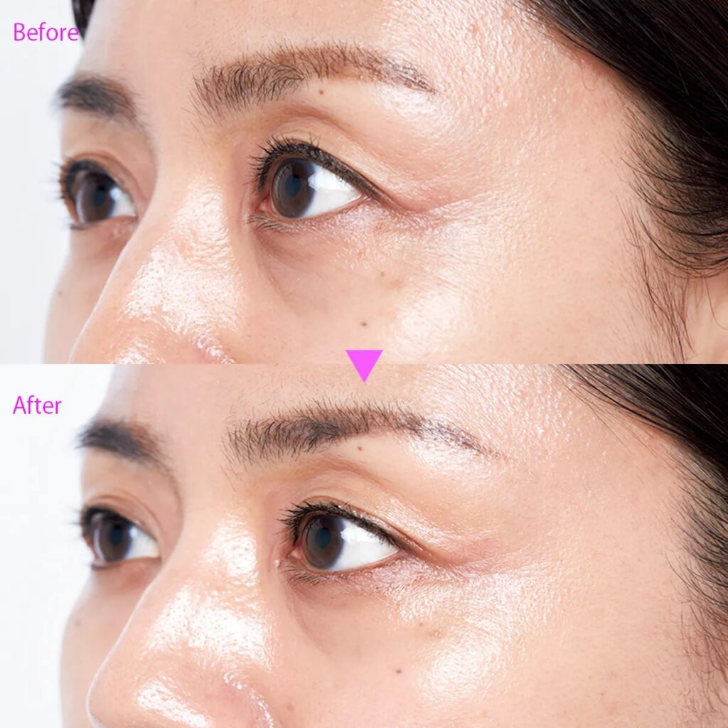 Shiseido Elixir — cамая продаваемая антивозрастная косметика в Японии 20 лет подряд 63 Антивозрастная косметика Shiseido Elixir: до/после