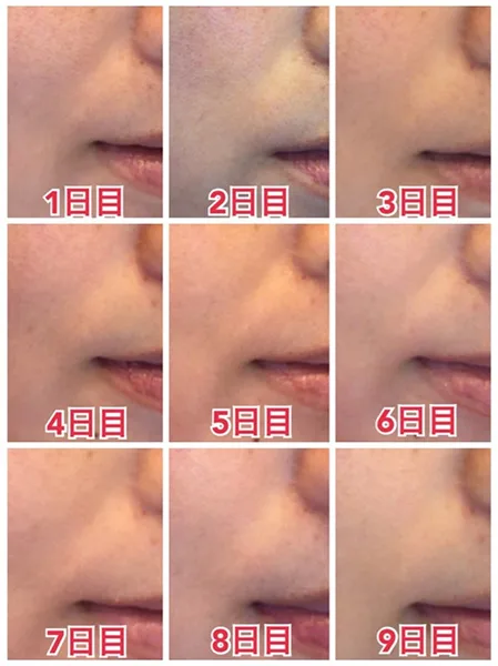 Японский питьевой коллаген: топ-9 39 collagen shiseido